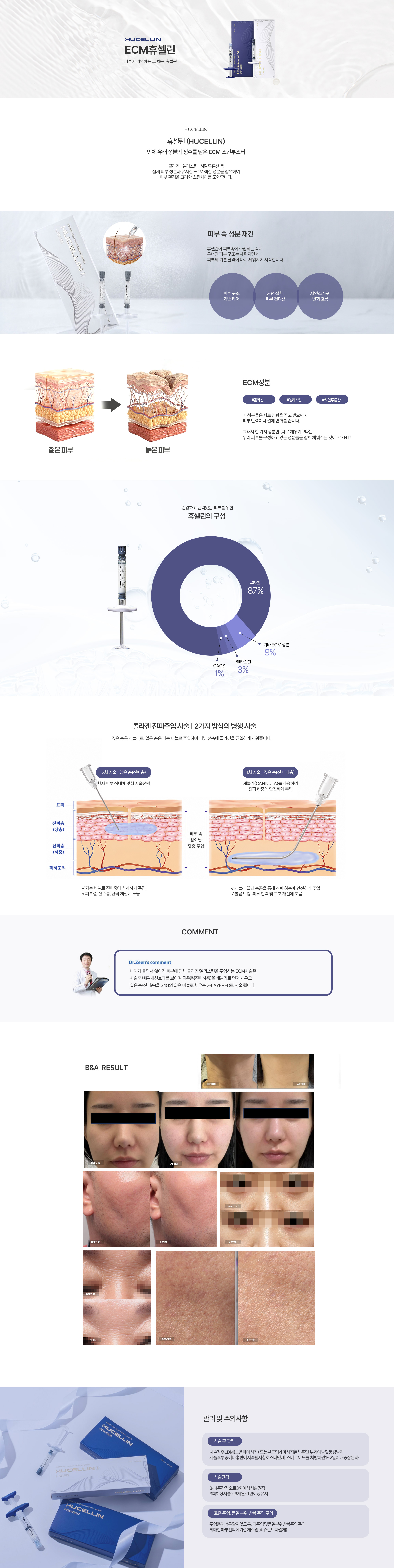 하이코 컨텐츠